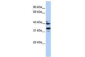 WB Suggested Anti-ZNF550 Antibody Titration:  0. (ZNF550 anticorps  (N-Term))