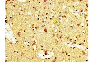 IHC image of ABIN7159233 diluted at 1:400 and staining in paraffin-embedded human brain tissue performed on a Leica BondTM system.
