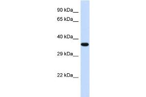 Western Blotting (WB) image for anti-Transducer of ERBB2, 2 (TOB2) (Middle Region) antibody (ABIN2774214) (TOB2 anticorps  (Middle Region))