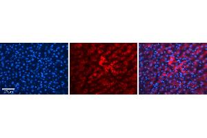 HP (haptoglobin)antibody - N-terminal region          Formalin Fixed Paraffin Embedded Tissue:  Human Liver Tissue    Observed Staining:  Cytoplasm in hepatocytes   Primary Antibody Concentration:  1:100    Secondary Antibody:  Donkey anti-Rabbit-Cy3    Secondary Antibody Concentration:  1:200    Magnification:  20X    Exposure Time:  0. (Haptoglobin anticorps  (N-Term))
