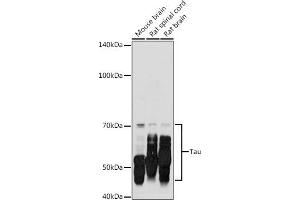 Western blot analysis of extracts of various cell lines, using Tau antibody (ABIN3021441, ABIN3021442, ABIN3021443 and ABIN6215045) at 1:500 dilution.