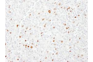 anti-Centromere Protein F (CENPF) (AA 2350-2400) antibody