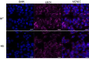 Immunocytochemical staining of HeLa cells using USO1 antibody (ABIN7800775), 1:1,000), Top panel: wild-type (WT), Bottom panal: USO1 shRNA knockdown (KD).