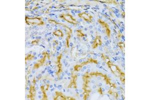 Immunohistochemistry of paraffin-embedded rat kidney using ARF6 Antibody (ABIN5971617) at dilution of 1/100 (40x lens). (ARF6 anticorps)