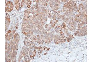 IHC-P Image Immunohistochemical analysis of paraffin-embedded SW480 xenograft, using HPS3, antibody at 1:500 dilution. (HPS3 anticorps  (C-Term))