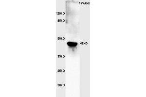 Rat brain lysates probed with Rabbit Anti-Actin Polyclonal Antibody, Unconjugated  at 1:3000 for 90 min at 37˚C.