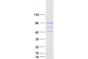 Validation with Western Blot