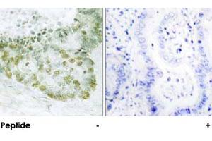 Immunohistochemical analysis of paraffin-embedded human heart tissue using TGFB1I1 polyclonal antibody . (TGFB1I1 anticorps)