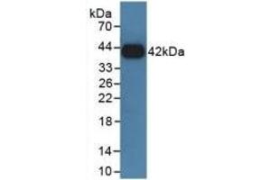 Detection of Recombinant GHR, Rat using Polyclonal Antibody to Growth Hormone Receptor (GHR) (Growth Hormone Receptor anticorps  (AA 353-588))