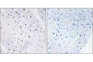 Immunohistochemistry analysis of paraffin-embedded human heart, using Bloom Syndrome (Phospho-Thr99) Antibody. (Bloom Syndrome (AA 65-114), (pThr99) anticorps)