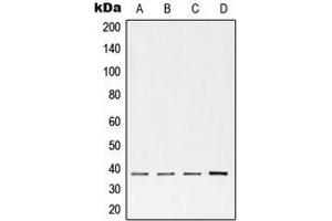 Western blot analysis of cTnT expression in H9 (A), 4T1 (B), human heart (C) whole cell lysates. (Cardiac Troponin T2 anticorps  (Center))