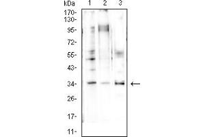 Western blot analysis using CCND1 mouse mAb against LNCAP (1), A431 (2), and NIH/3T3 (3) cell lysate.
