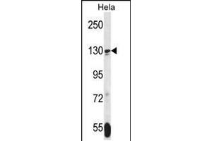Western blot analysis in Hela cell line lysates (35ug/lane). (TNKS anticorps  (N-Term))
