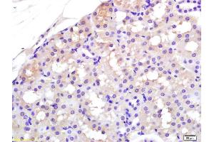 Formalin-fixed and paraffin embedded rat kidney labeled with Rabbit Anti APAF1(NT) Polyclonal Antibody, Unconjugated (ABIN724310) at 1:200 followed by conjugation to the secondary antibody and DAB staining (APAF1 anticorps  (AA 13-80))