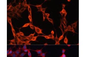 Immunofluorescence analysis of NIH/3T3 cells using SLC25A23 Polyclonal Antibody at dilution of 1:100. (SLC25A23 anticorps)