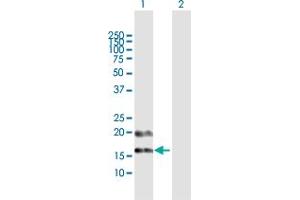 Western Blot analysis of PFDN4 expression in transfected 293T cell line by PFDN4 MaxPab polyclonal antibody. (PFDN4 anticorps  (AA 1-134))