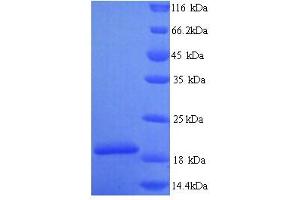 SDS-PAGE (SDS) image for Group XIIA Secretory Phospholipase A2 (PG12A) (AA 23-185), (partial) protein (His tag) (ABIN5714468) (PG12A Protein (AA 23-185, partial) (His tag))