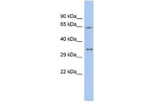 WB Suggested Anti-MIF4GD Antibody Titration:  0. (MIF4GD anticorps  (N-Term))