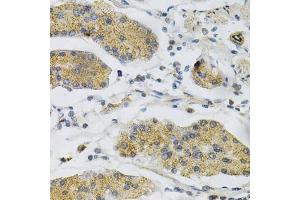 Immunohistochemistry of paraffin-embedded human stomach using PTPRA Antibody (ABIN3015783, ABIN3015784, ABIN1682399 and ABIN6219134) at dilution of 1:100 (40x lens).