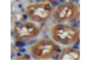 Used in DAB staining on fromalin fixed paraffin-embedded Kidney tissue (Laminin alpha 1 anticorps  (AA 886-1039))