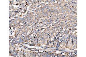 IHC analysis of RPL17 using anti-RPL17 antibody (ABIN7601639).