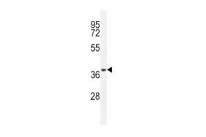 Western blot analysis in A549 cell line lysates (35ug/lane).