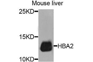 Western blot analysis of extracts of mouse liver, using HBA2 antibody. (HBa2 anticorps  (AA 1-142))