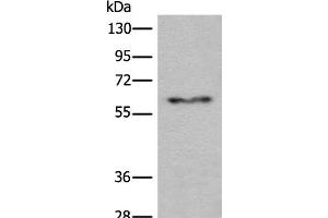 Western blot analysis of Human fetal liver tissue lysate using CES2 Polyclonal Antibody at dilution of 1:600 (CES2 anticorps)