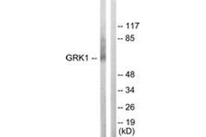 Western blot analysis of extracts from COLO205 cells, using GRK1 (Ab-21) Antibody. (GRK1 anticorps  (AA 6-55))