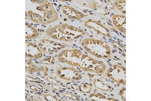 Immunohistochemistry of paraffin-embedded human kidney using GSTT1 antibody at dilution of 1:200 (x400 lens)