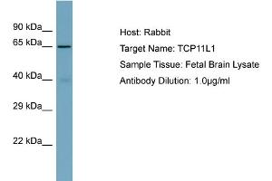 Host: Rabbit Target Name: TCP11L1 Sample Type: Fetal Brain lysates Antibody Dilution: 1. (TCP11L1 anticorps  (C-Term))