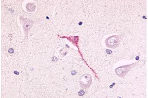 Anti-GPR17 antibody  ABIN1048752 IHC staining of human brain, neurons and glia. (GPR17 anticorps  (N-Term))