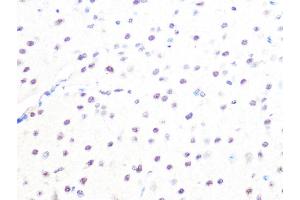 Immunohistochemistry of paraffin-embedded mouse brain using MB/MB/ML2 Rabbit mAb (ABIN1679325, ABIN3019109, ABIN3019110 and ABIN7101716) at dilution of 1:100 (40x lens).