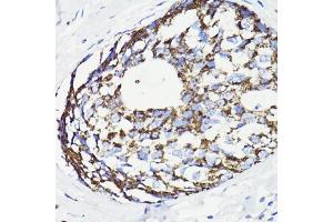 Immunohistochemistry of paraffin-embedded rat spleen using PDCD10 antibody (ABIN7269540) at dilution of 1:100 (40x lens).
