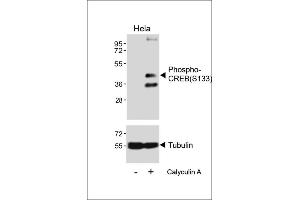 Western blot analysis of lysates from Hela cell line, untreated or treated with 20 % FBS + 100nM Calyculin A, using Phospho-CREB Antibody (upper) or tubulin(lower).