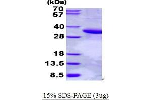 Image no. 1 for phospholipid Scramblase 1 (PLSCR1) (AA 1-288) protein (His tag) (ABIN7280010)