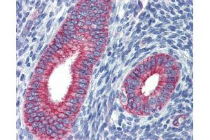 Human uterus; Anti-ZNF71 antibody IHC staining of human uterus. (ZNF71 anticorps)
