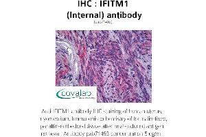 anti-Interferon-Induced Transmembrane Protein 1 (IFITM1) (Internal Region) antibody