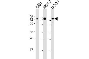 All lanes : Anti-BAG3 Antibody (N-Term) at 1:2000 dilution Lane 1: A431 whole cell lysate Lane 2: MCF-7 whole cell lysate Lane 3: U-2OS whole cell lysate Lysates/proteins at 20 μg per lane. (BAG3 anticorps  (AA 31-62))