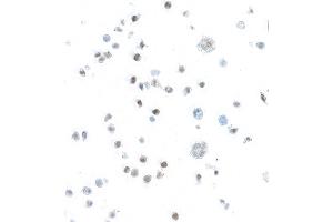 Immunocytochemistry (ICC) image for anti-Signal Transducer and Activator of Transcription 5B (STAT5B) (AA 737-787) antibody (ABIN7455110) (Recombinant STAT5B anticorps  (AA 737-787))