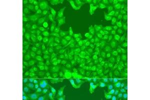Immunofluorescence analysis of U2OS cells using TAZ Polyclonal Antibody at dilution of 1:100. (TAZ anticorps)
