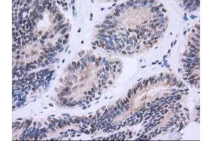 Image no. 8 for anti-Nonhomologous End-Joining Factor 1 (NHEJ1) antibody (ABIN1499729) (NHEJ1 anticorps)