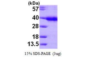 SDS-PAGE (SDS) image for HUS1 Checkpoint Homolog (S. Pombe) (HUS1) (AA 1-280) protein (His tag) (ABIN6386651)
