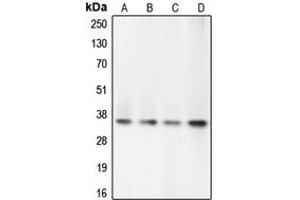 Western blot analysis of Caspase 7 expression in PC12 (A), Jurkat (B), HeLa (C), HEK293T (D) whole cell lysates. (Caspase 7 anticorps  (N-Term))