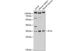 Western blot analysis of extracts of various cell lines, using BTLA antibody (ABIN6129970, ABIN6137689, ABIN6137691 and ABIN6217450) at 1:1000 dilution. (BTLA anticorps  (AA 31-241))