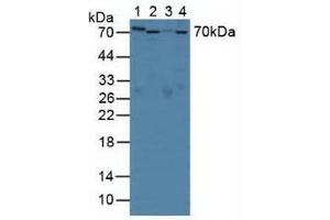 Western blot analysis of (1) Rat Serum, (2) Rat Liver Tissue, (3) Rat Placenta Tissue and (4) Mouse Liver Tissue. (SERPINA10 anticorps  (AA 278-425))