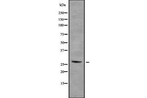 Western blot analysis of RPA30 using COLO205 whole cell lysates (RPA4 anticorps  (Internal Region))