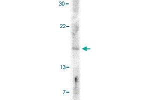 Western blot analysis of IFNB1 in A-20 cell lysate with IFNB1 polyclonal antibody  at 5 ug/mL . (IFNB1 anticorps  (Internal Region))