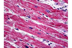 Anti-SPRY1 antibody IHC of human heart.