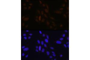 Immunofluorescence analysis of U-2 OS cells using Pea3 / ETV4 Rabbit pAb (ABIN6131217, ABIN6140332, ABIN6140334 and ABIN6221480) at dilution of 1:100 (40x lens).
